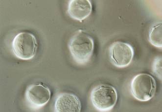 Bremia lactucae-15-sporangi
