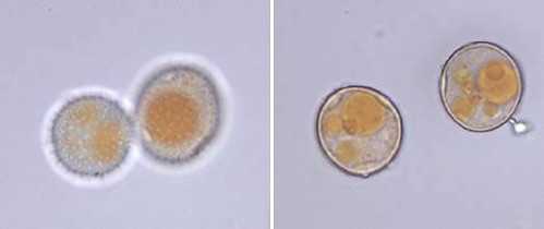 puccinia recondita sp. secalis-ürediosporlar-1