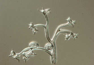 Bremia lactucae-14-sporangiofor - sporangi