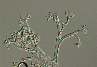 Bremia lactucae-13-sporangiofor