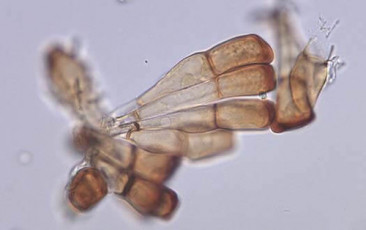 puccinia recondita sp. secalis-teliospor hücresi